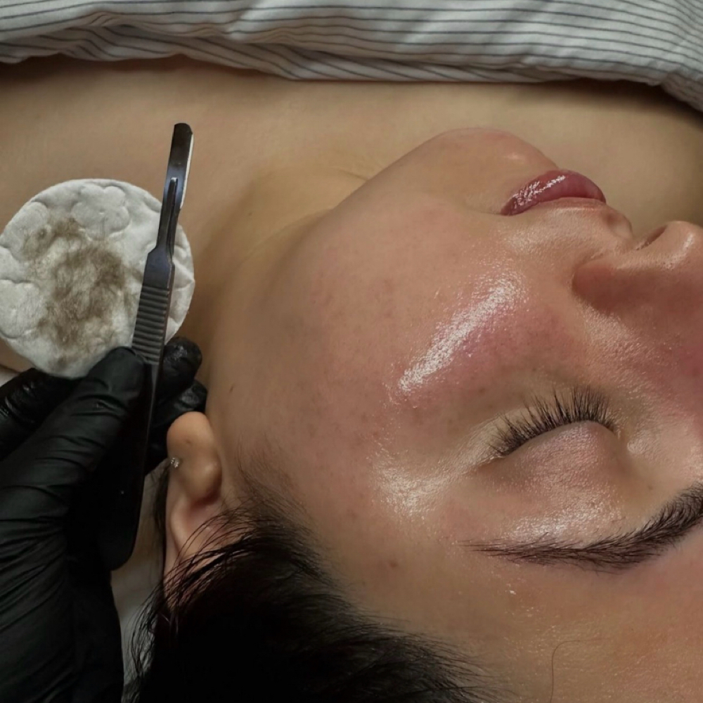 Signature Dermaplane Facial at Graceful Effects Day Spa in Brandon, MS