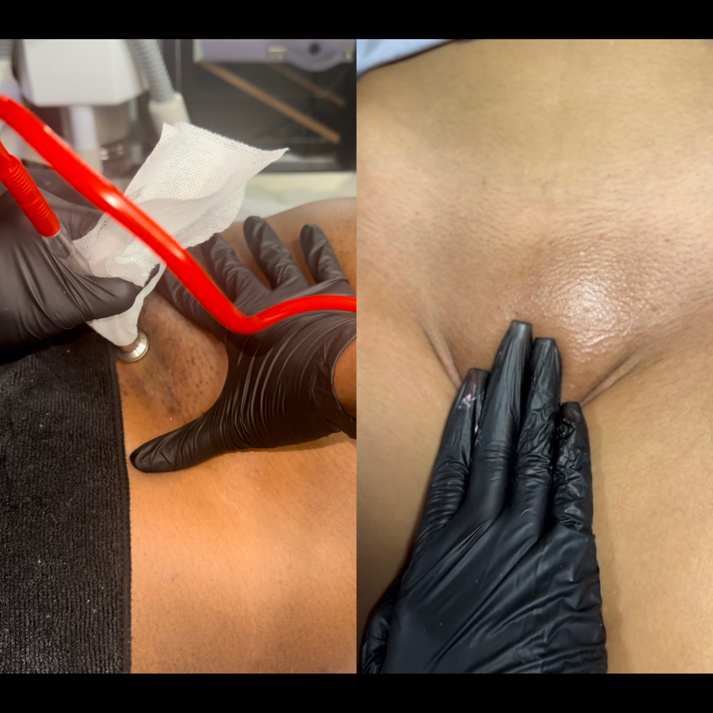 Brazilian Wax + Deluxe Vajacial