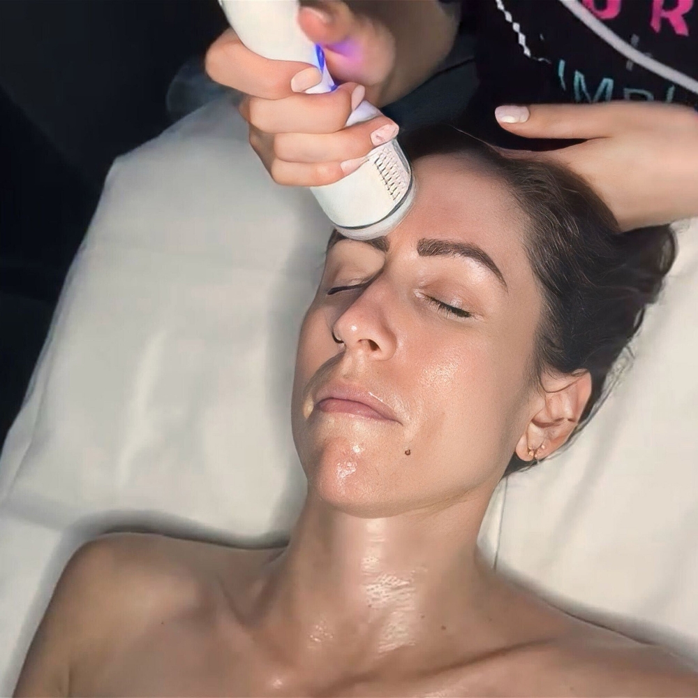 CryoSoothe Facial