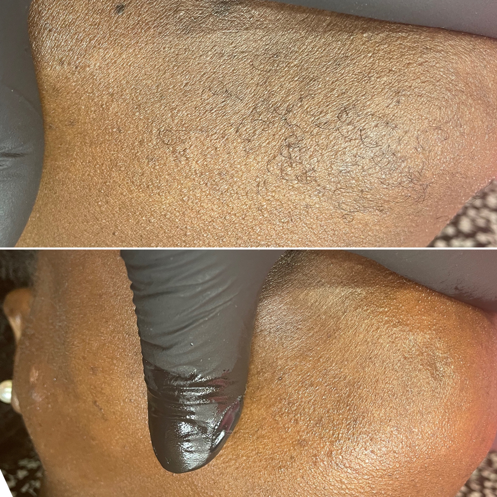 Chin Wax