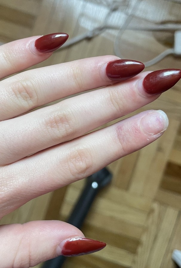 Nail Repair