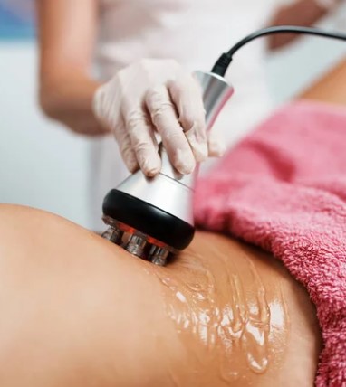 RF Body Contour 8 Session Package