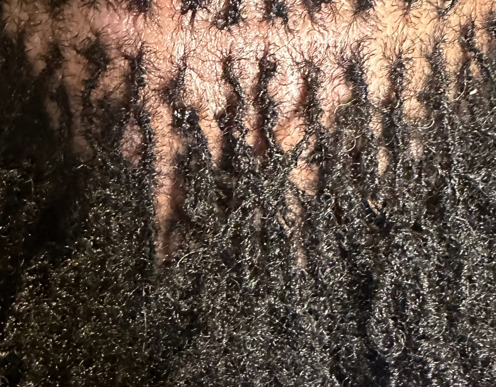 Braidlocs