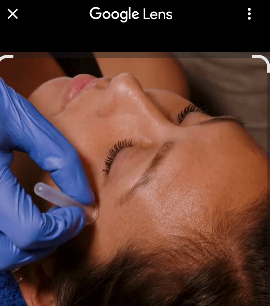 Facial Cupping Add-on