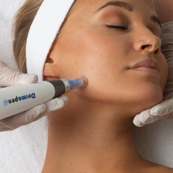 Micro Needling Scars PA