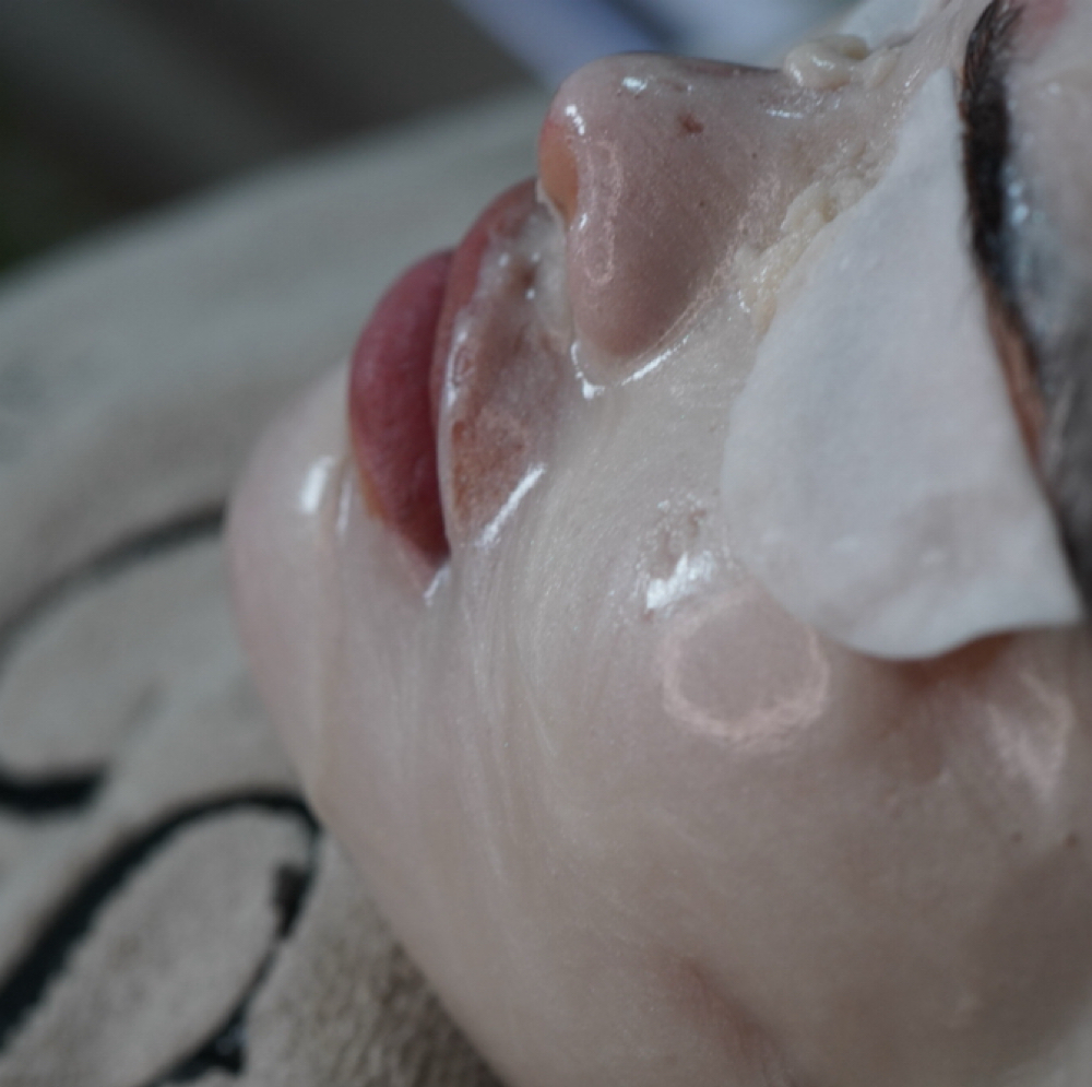 Acne Control Facial at GIRONDA MIAMI in MIAMI, FL