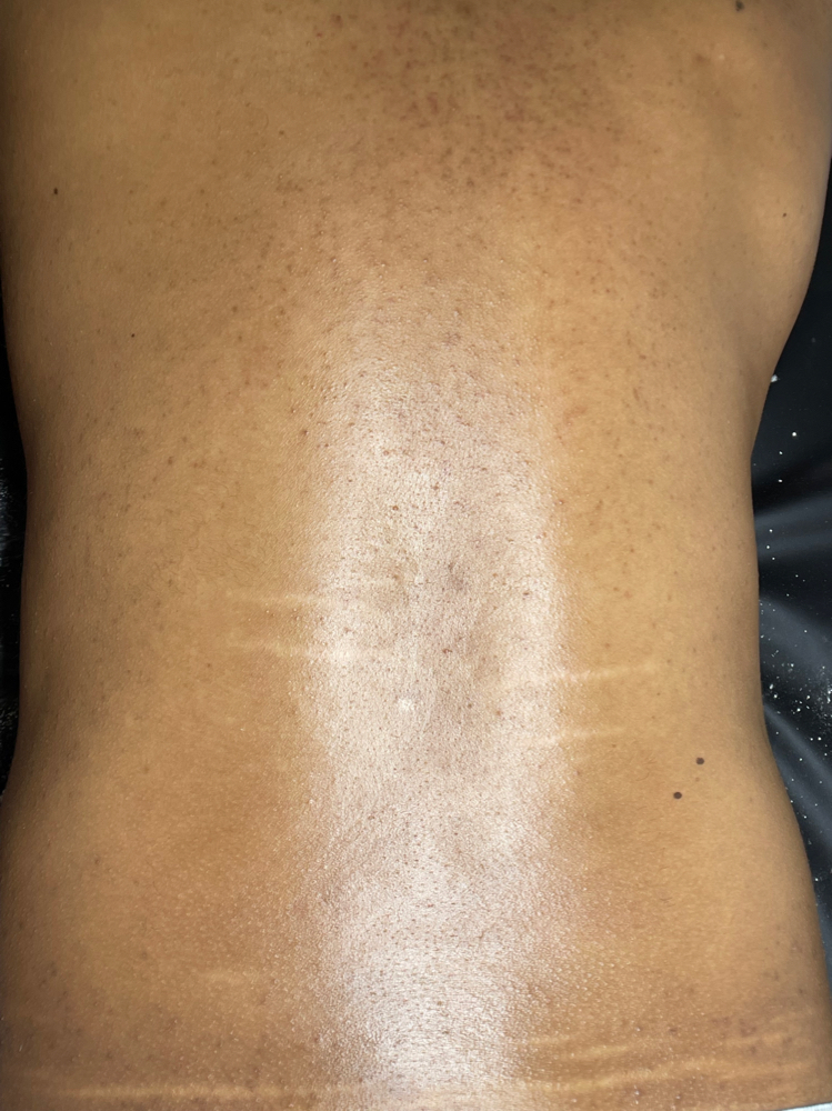 Back Wax (half)