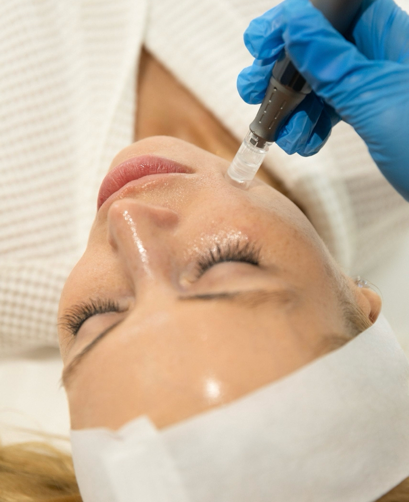 Nano Infusion Add-on