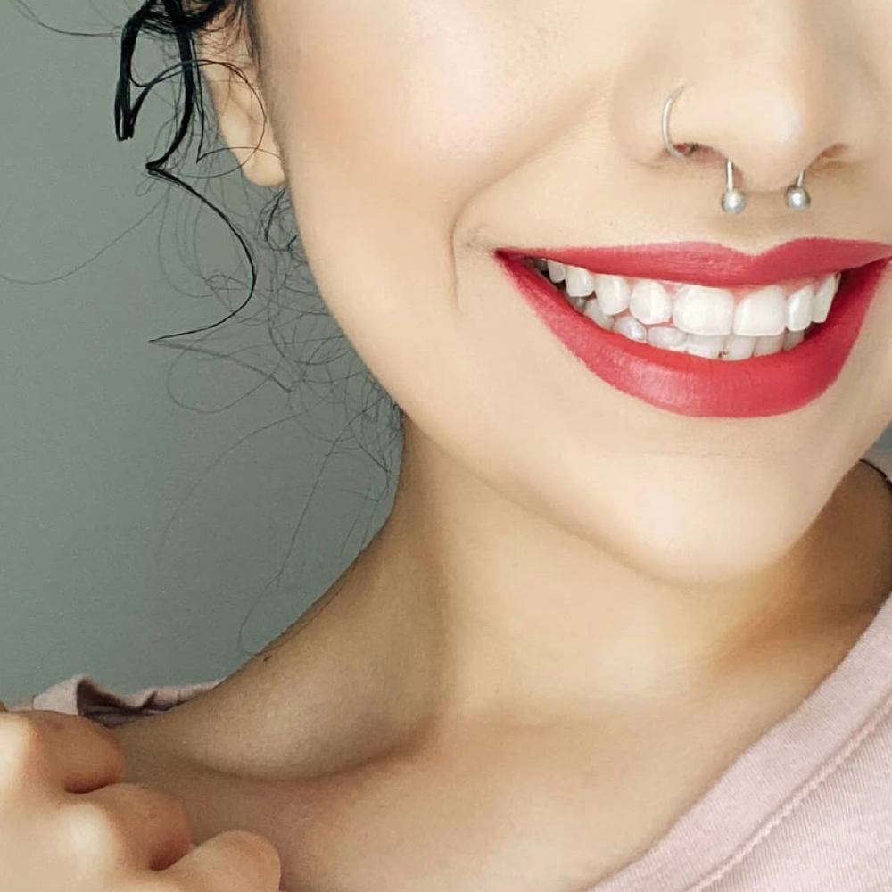 Teeth Whitening at Bare Beauty Method LLC in Leander, TX