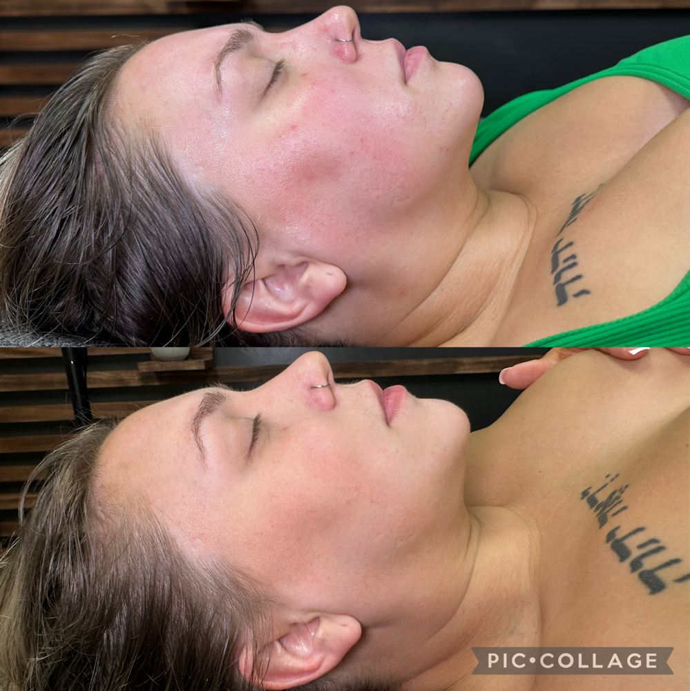 Lymphatic Glow Facial at Ciao Bellä Esthetics WNC in Asheville, NC