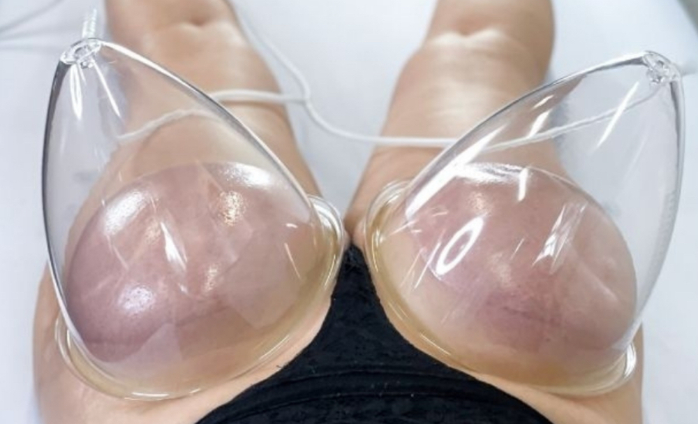 Non-Invasive BBL (3sessions)