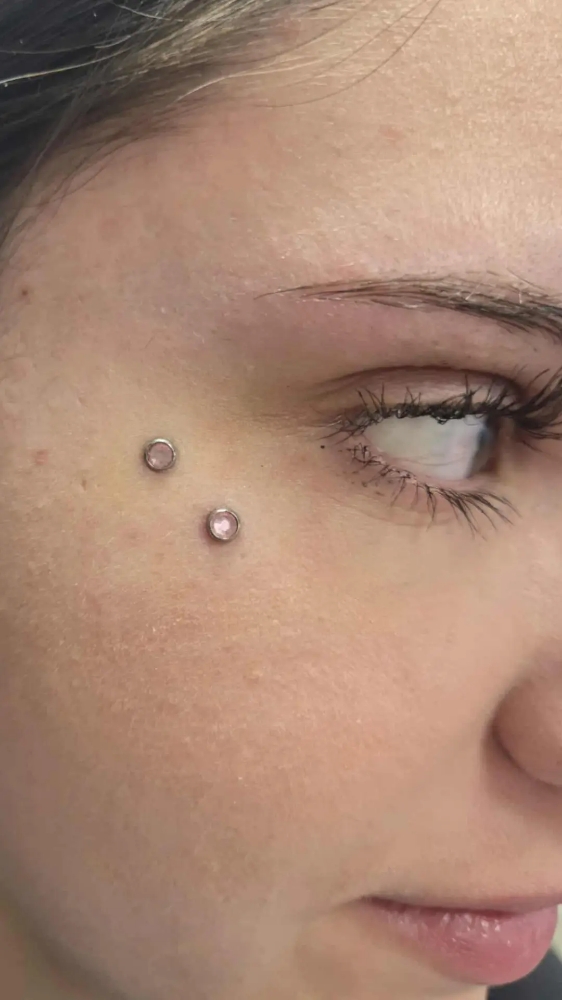 Micro Dermal, Single