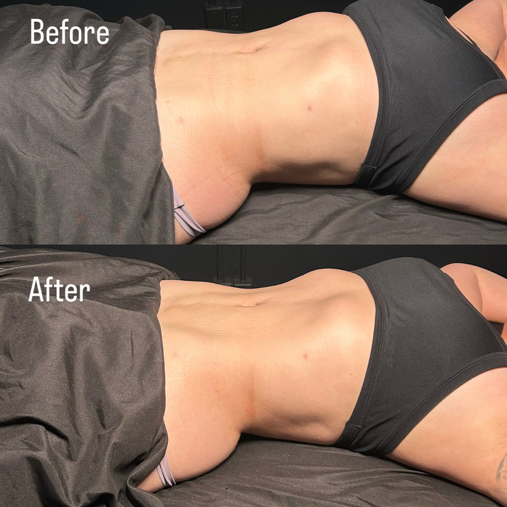 Full Body Lymphatic Drainage