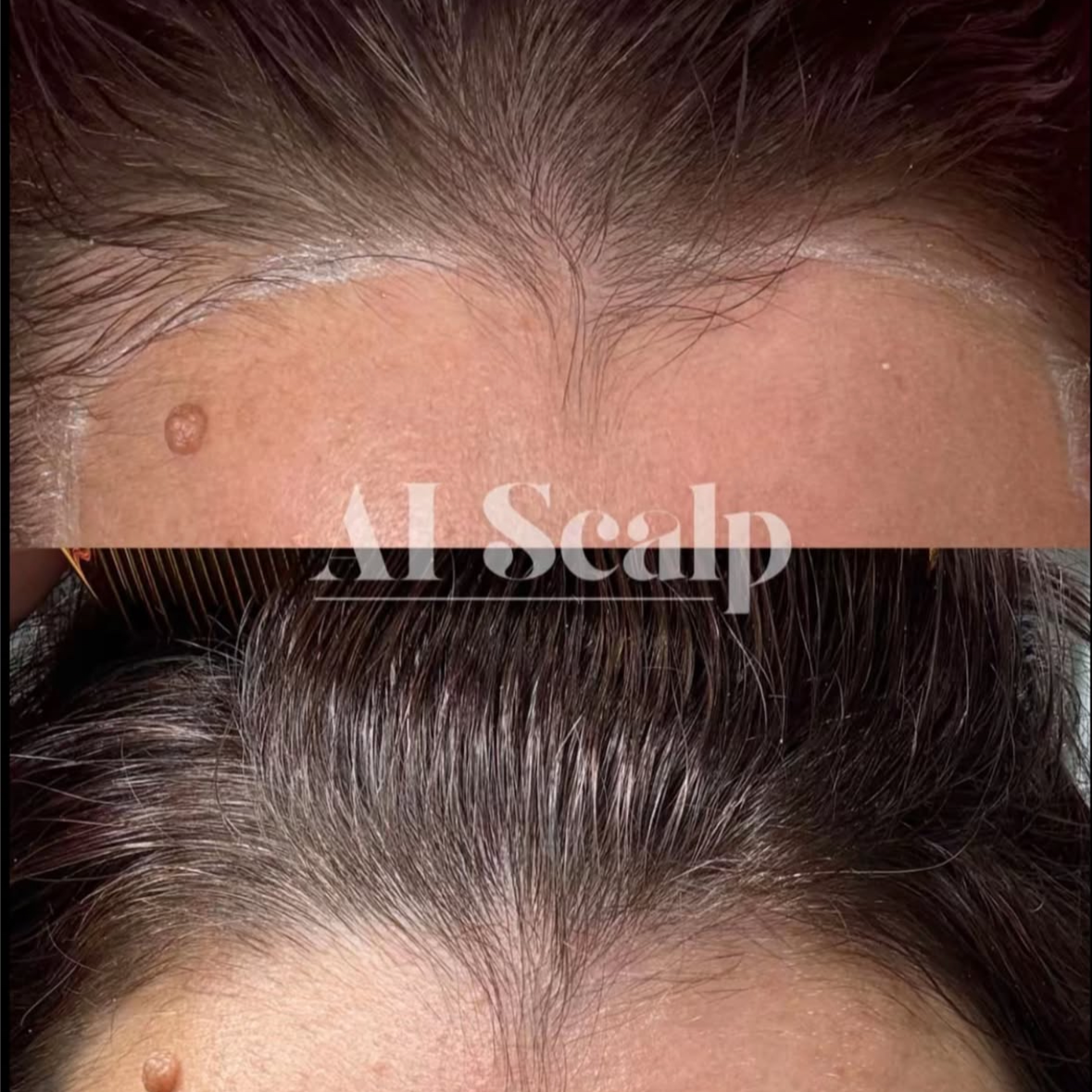 Ai Scalp - 4pk/Full Scalp at Alchemy Haus by Devyn | Color. Extensions. Scalp Density. in Atlanta, GA