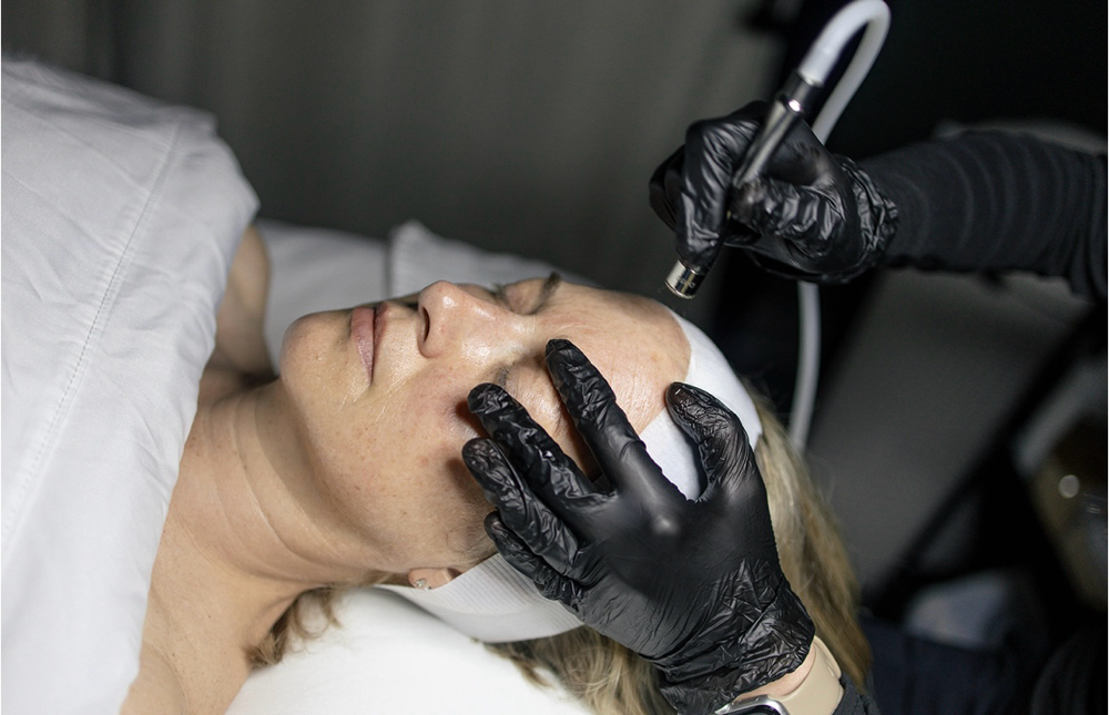 Microdermabrasion facial