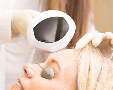 INTENSE PULSED LIGHT Laser Facial