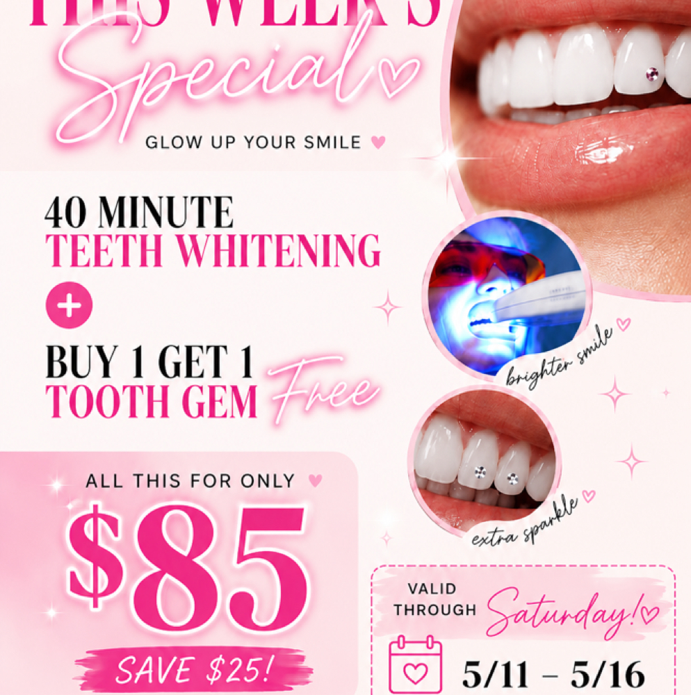 40 MIN WHITENING BOGO 2 TOOTH GEMS at Unique Smiles By Toni in Columbia, SC