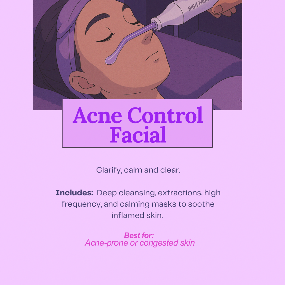 Acne Control Facial