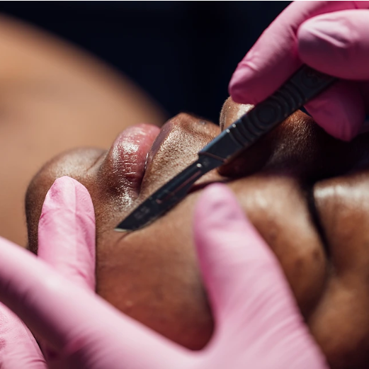Dermaplane