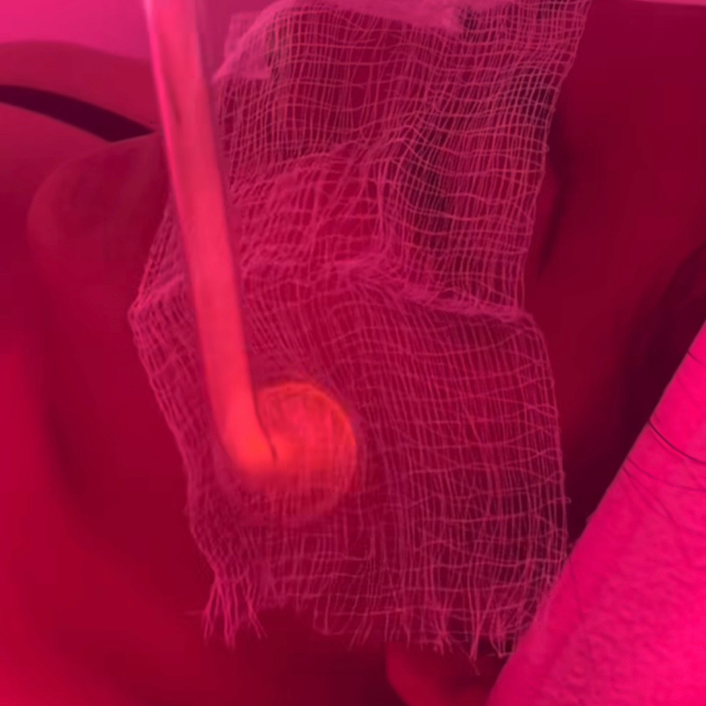 Oxygen High Frequency Facial