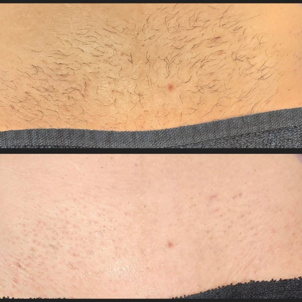 Brazilian (4-6 week maintenance) at The Mane Lounge in Virginia Beach, VA