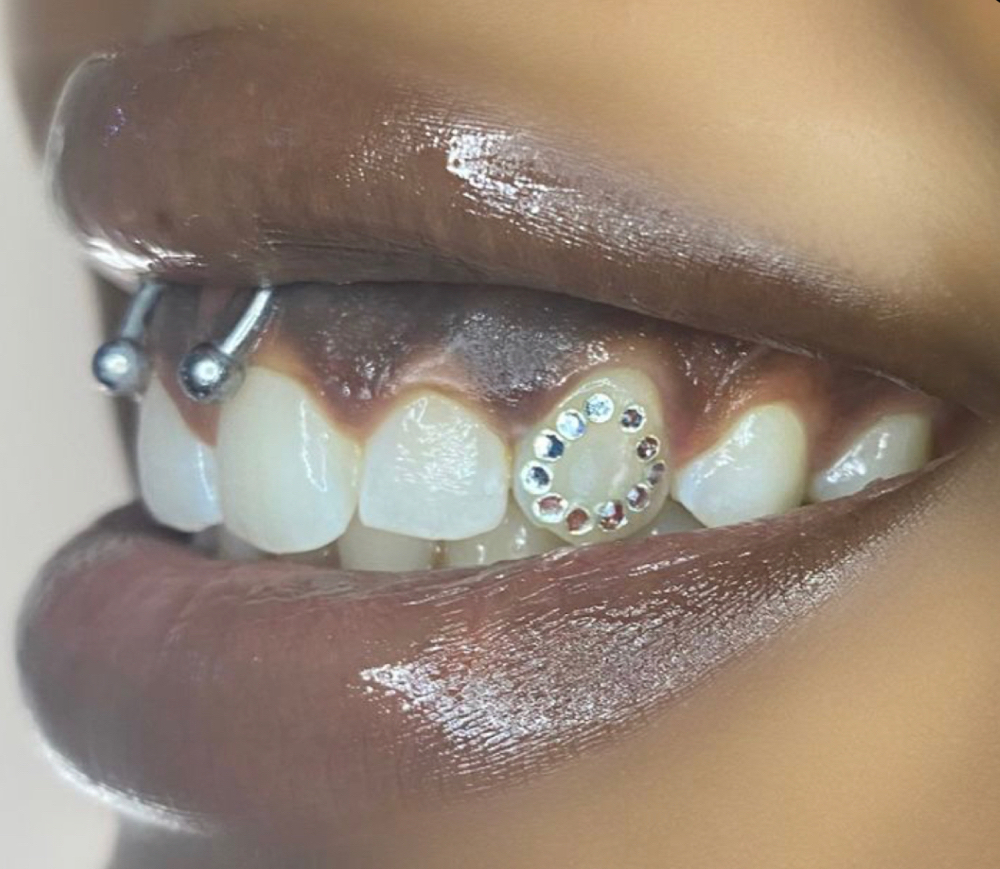 Halo Tooth Gem