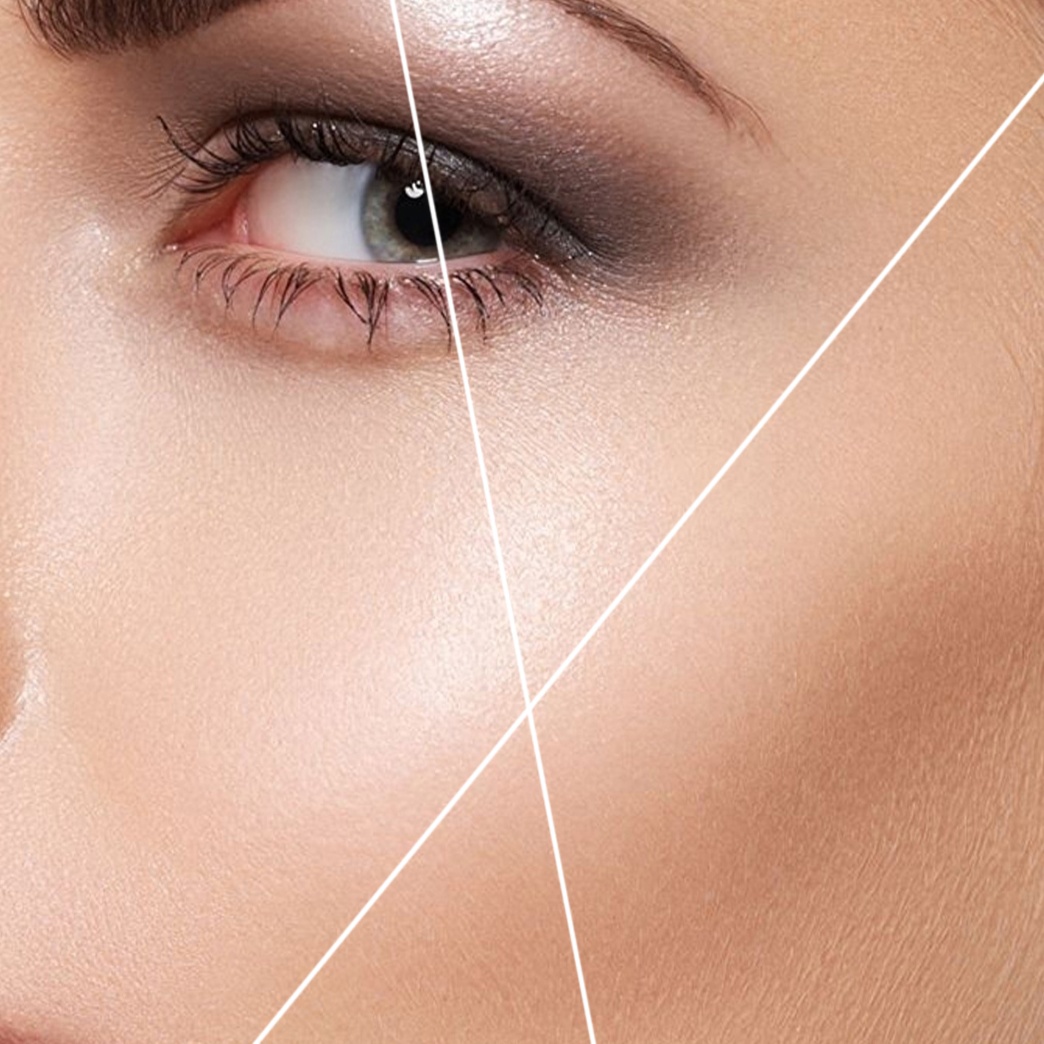 Full Face, Eyebrow, Neck And Mask at AR Touch in Marietta, GA
