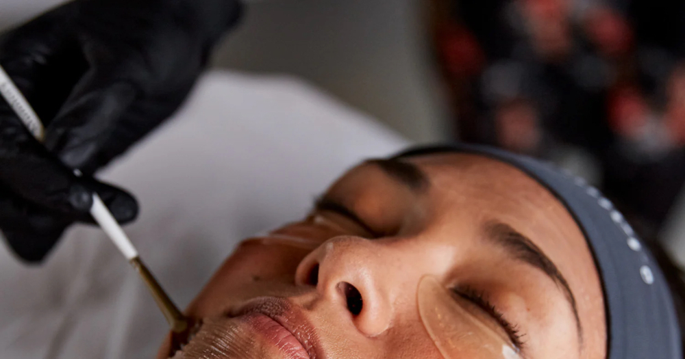 ALUMIER CHEMICAL PEEL CONSULTATION