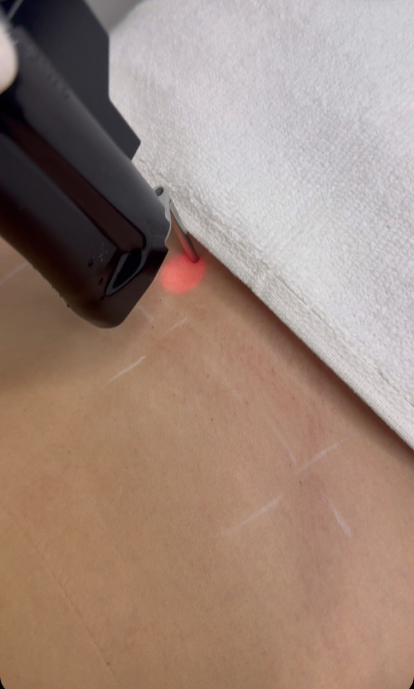 L HR Special 3 (6 areas)6 session