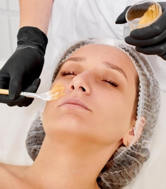 Cheeks Waxing
