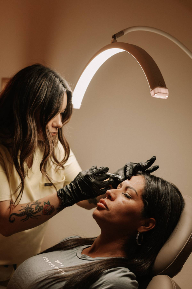 Crows Feet at Aura Skin x Marissa in Alice, TX