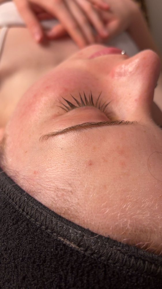 The Velvet Detox (Acne Prone)