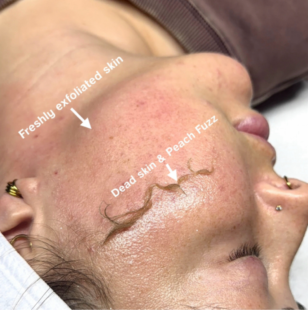 Dermaplane Facial (Deluxe) at Glow by Chelsea in Lewisburg, TN