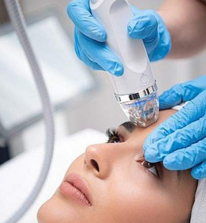 Fractional Rf Laser