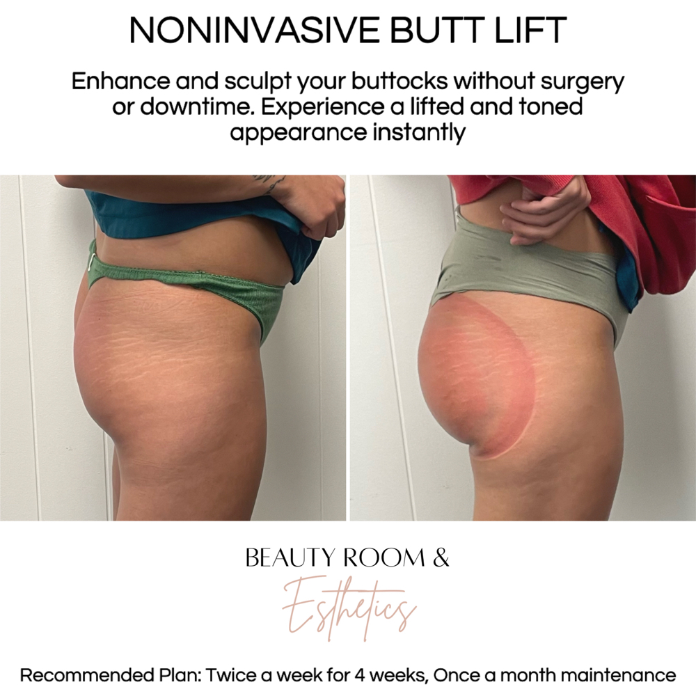 3 Sessions Noninvasive BBL