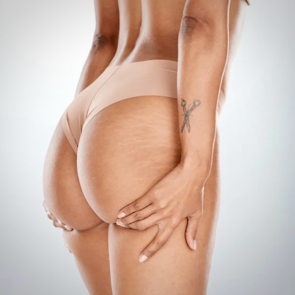 Noninvasive BBL