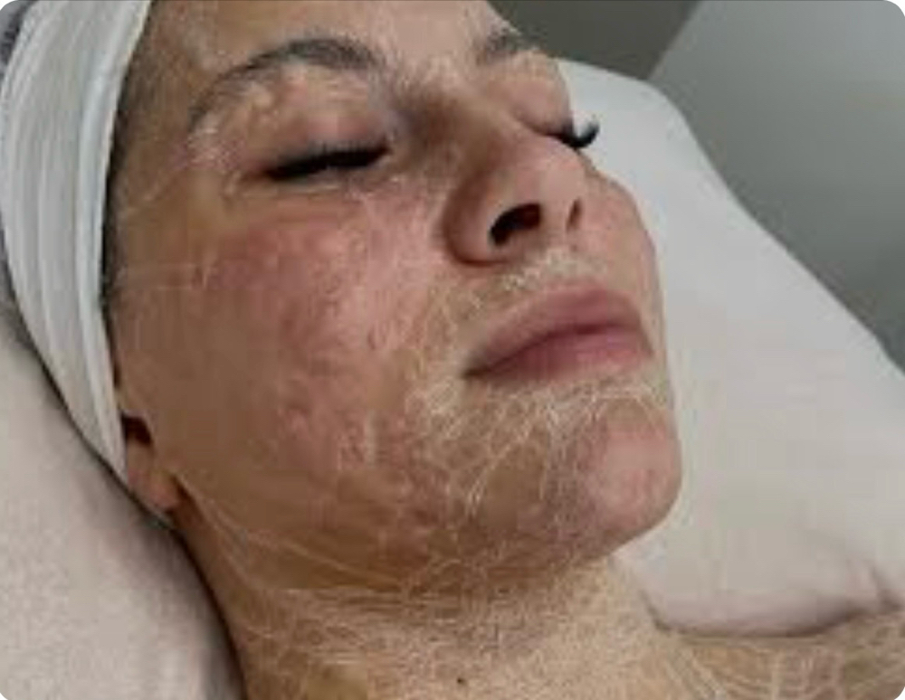 Firming Peptide, Botox Facial