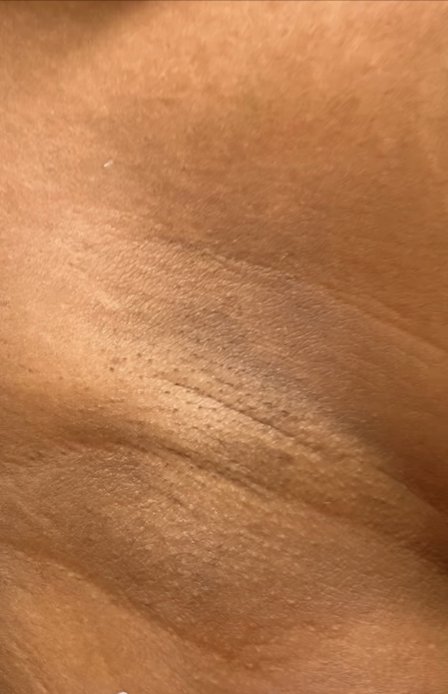 Armpits