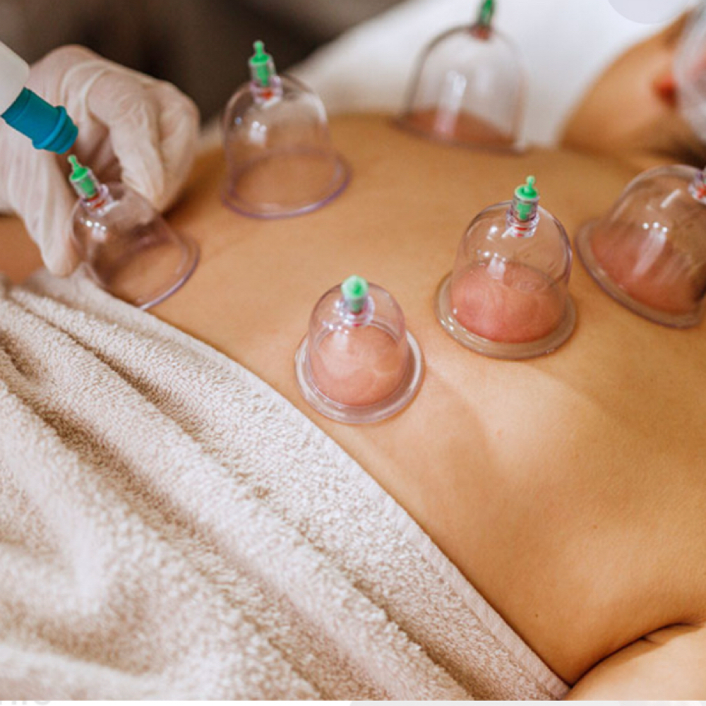 Cupping Therapy at Massage By Esly in Manteca, CA