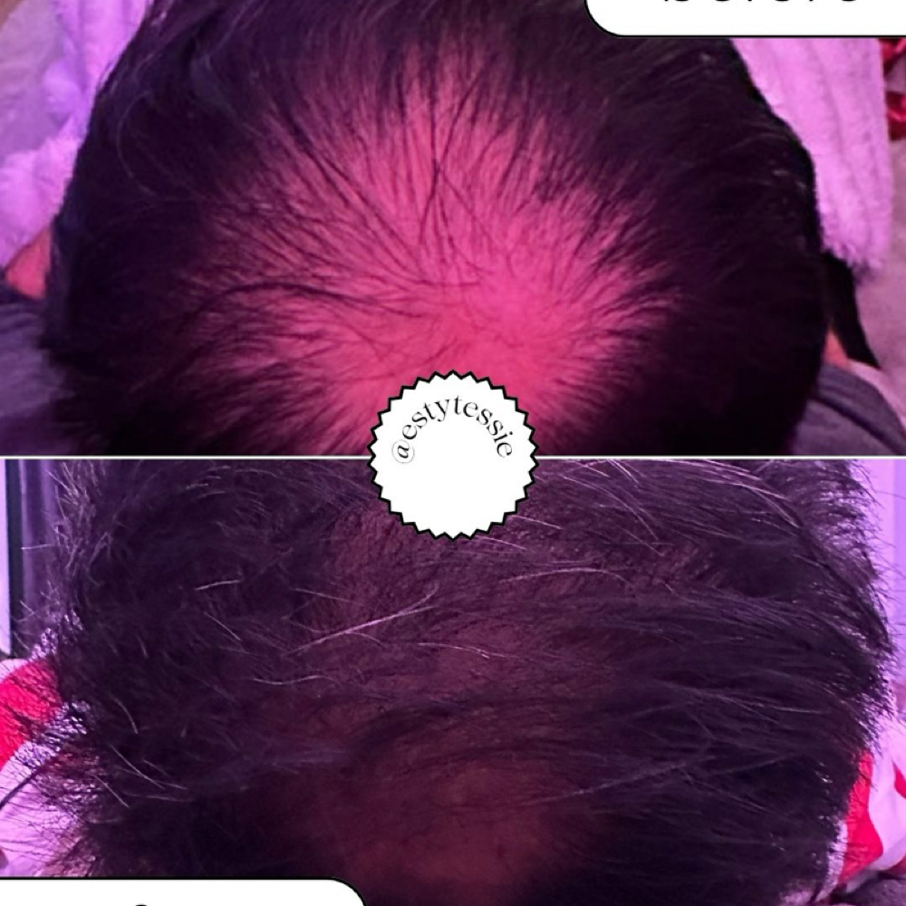 Hair Renewal Consutation at TesSpa in Issaquah, WA