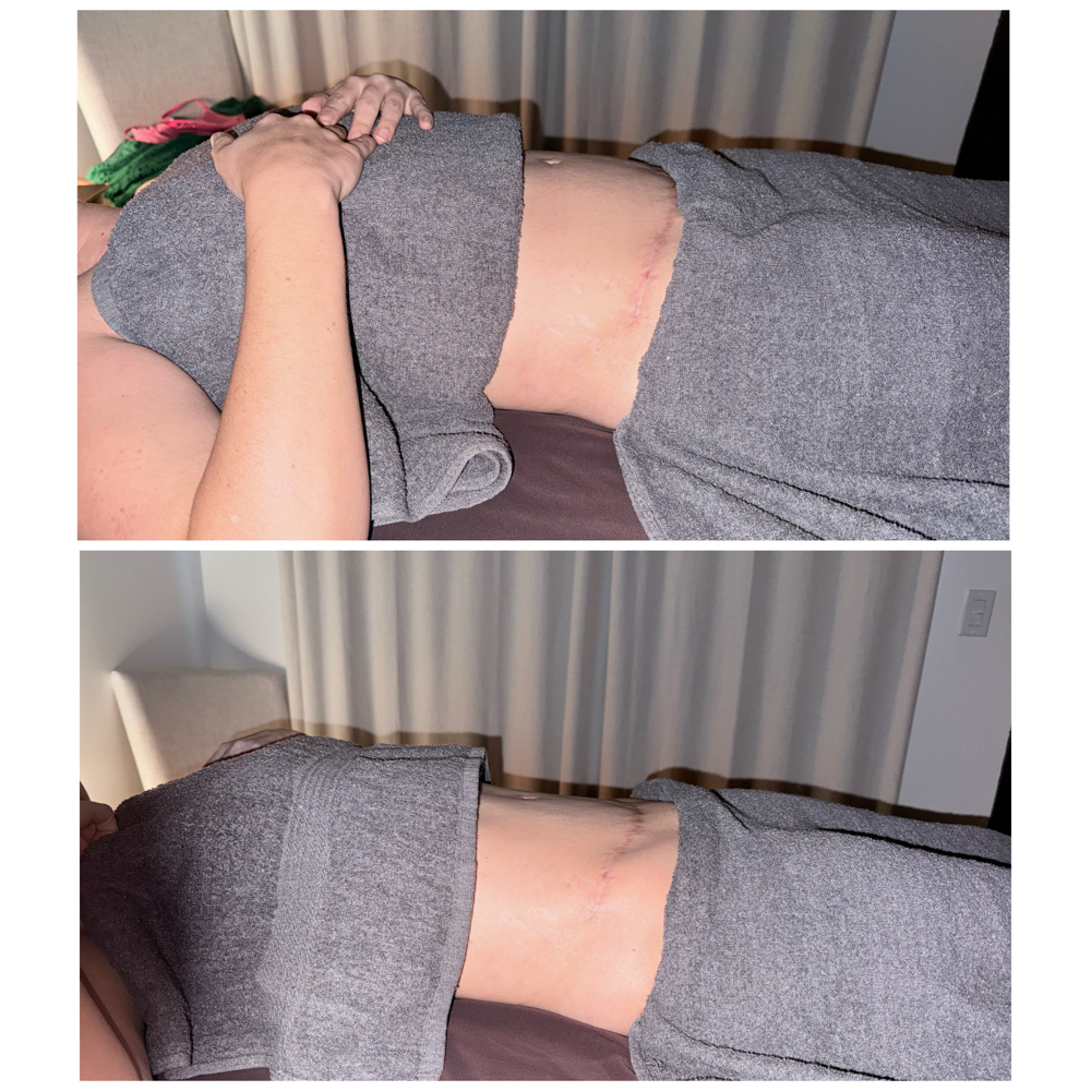 Brazilian Lymphatic Drainage. at T.I.M.E- The Intuitive Massage Experience in Kyle, TX