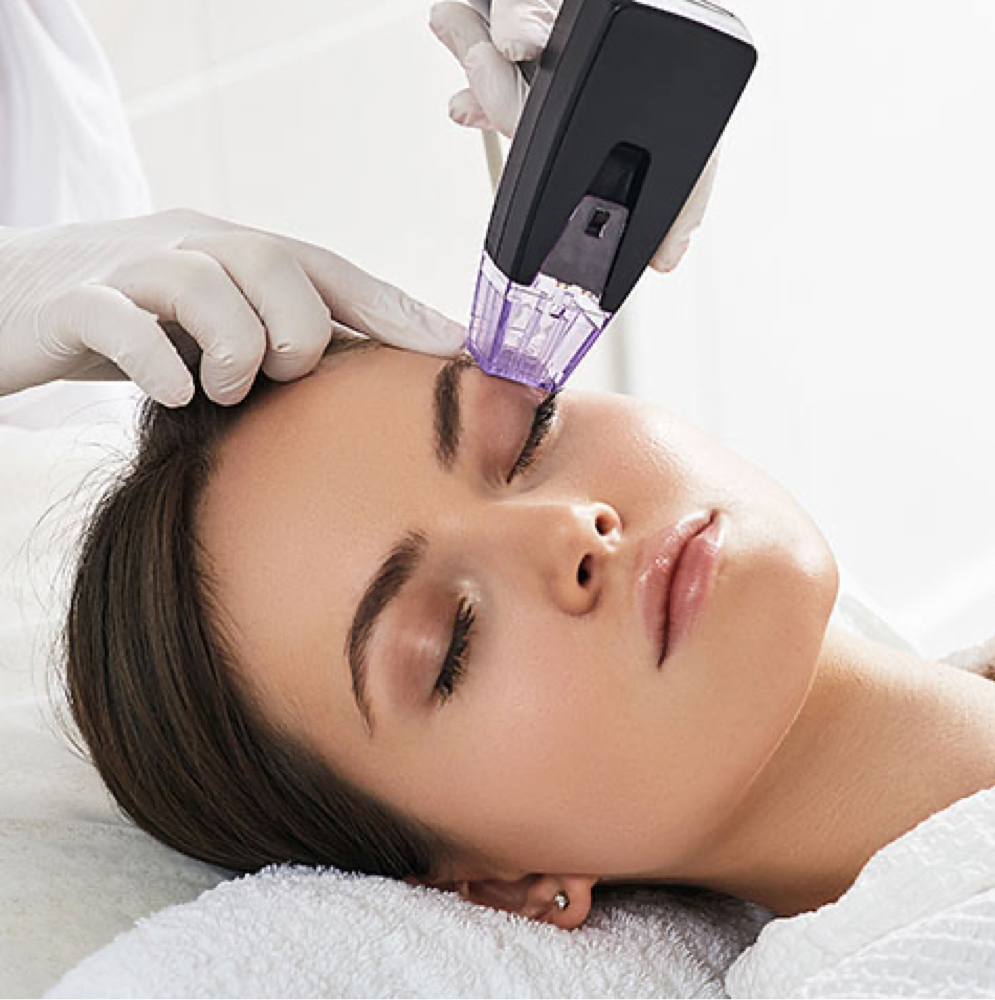 RF Microneedling