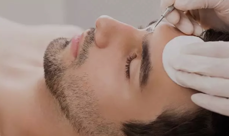 Extraction Facial