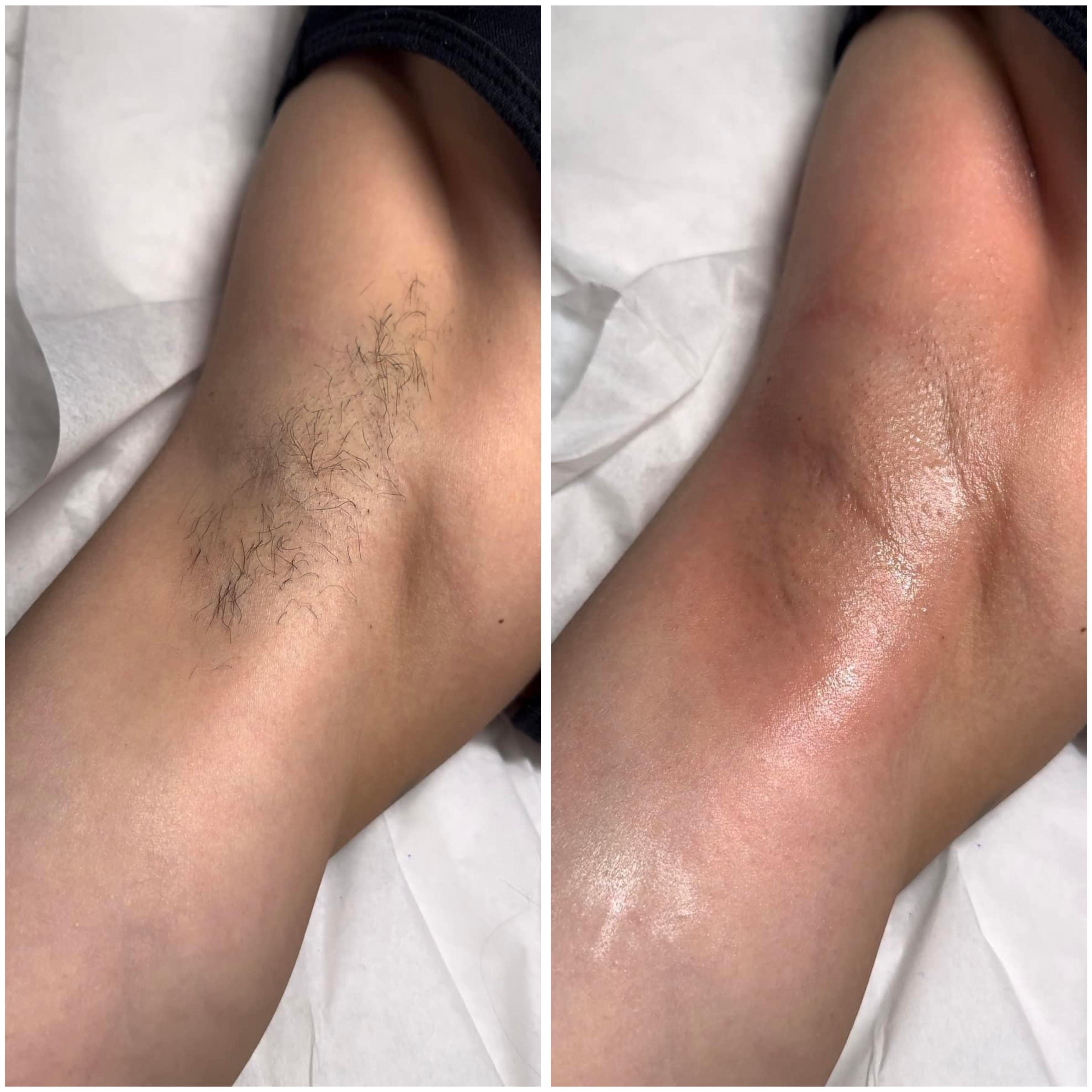 Underarm Wax
