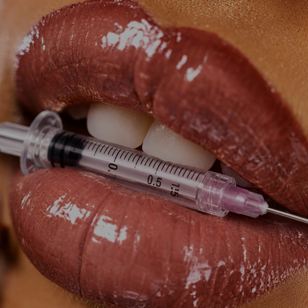 Lip Filler at Designed By T in Frisco, TX