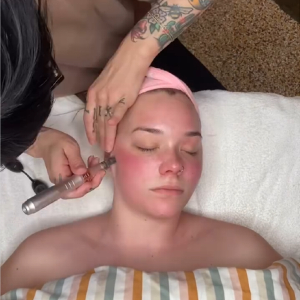 Nano-Infusion Pen Add On at The Pretty Peach in Chippewa Falls, WI