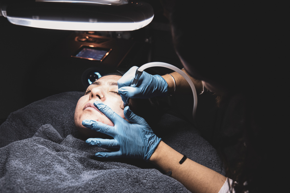 Microdermabrasion Facial