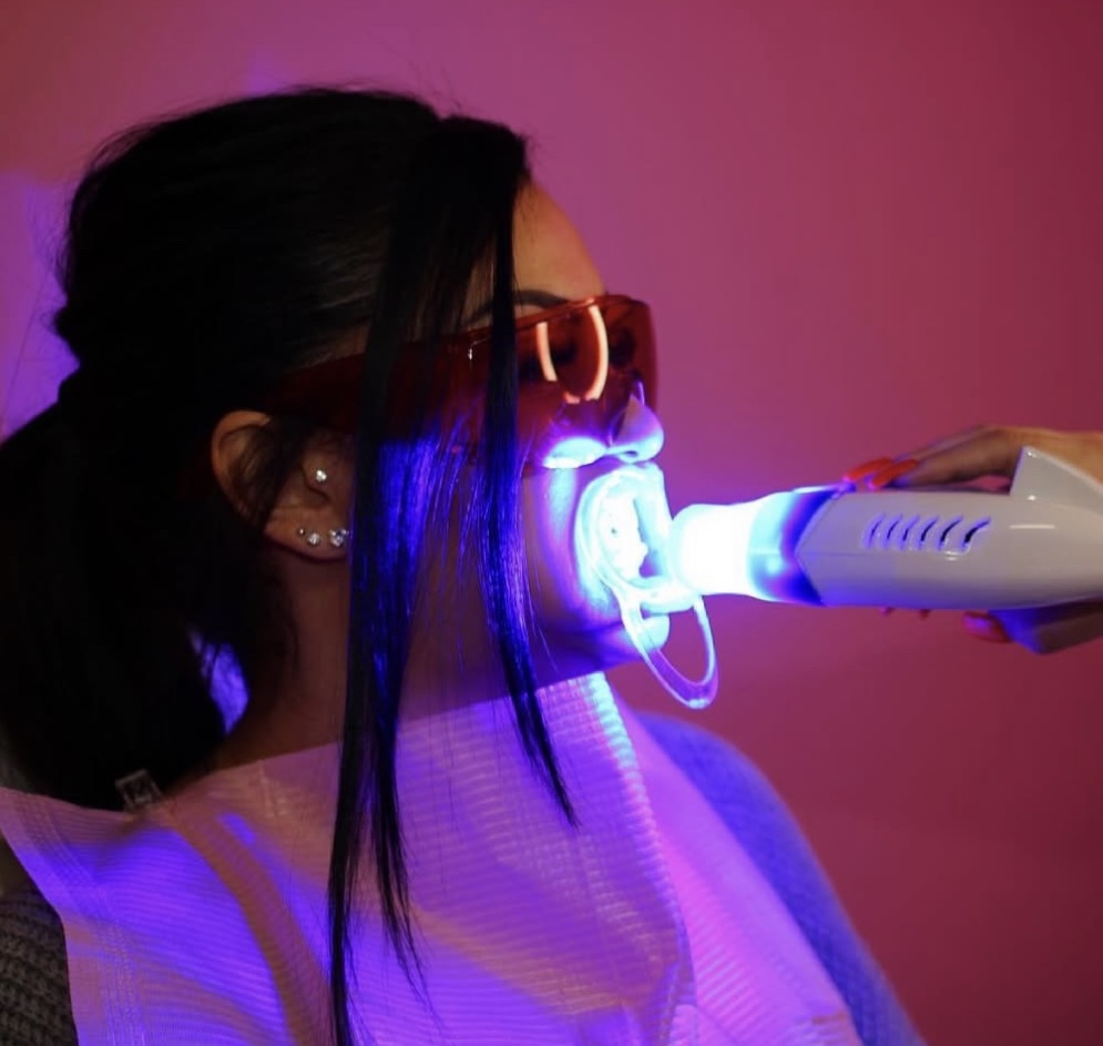 Teeth Whitening at Snatch Me Up in Renton, WA
