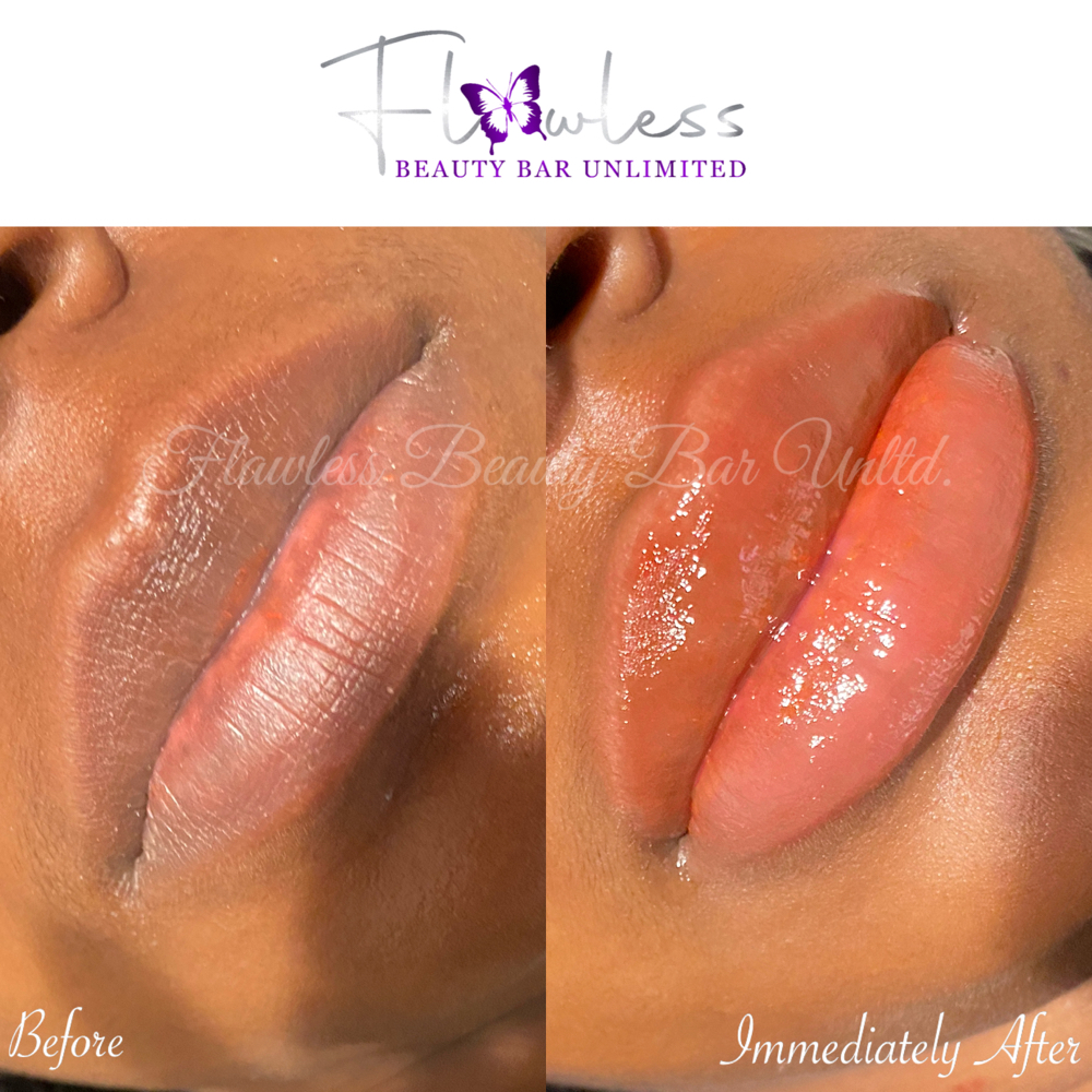 Lip Neutralization / Lip Blush