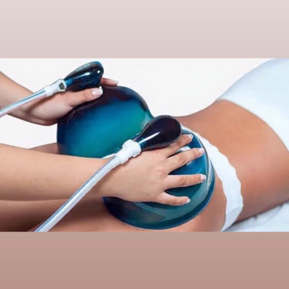 Butt Cupping- 30 MIN at Luminous Luxe Spa in Nutley, NJ